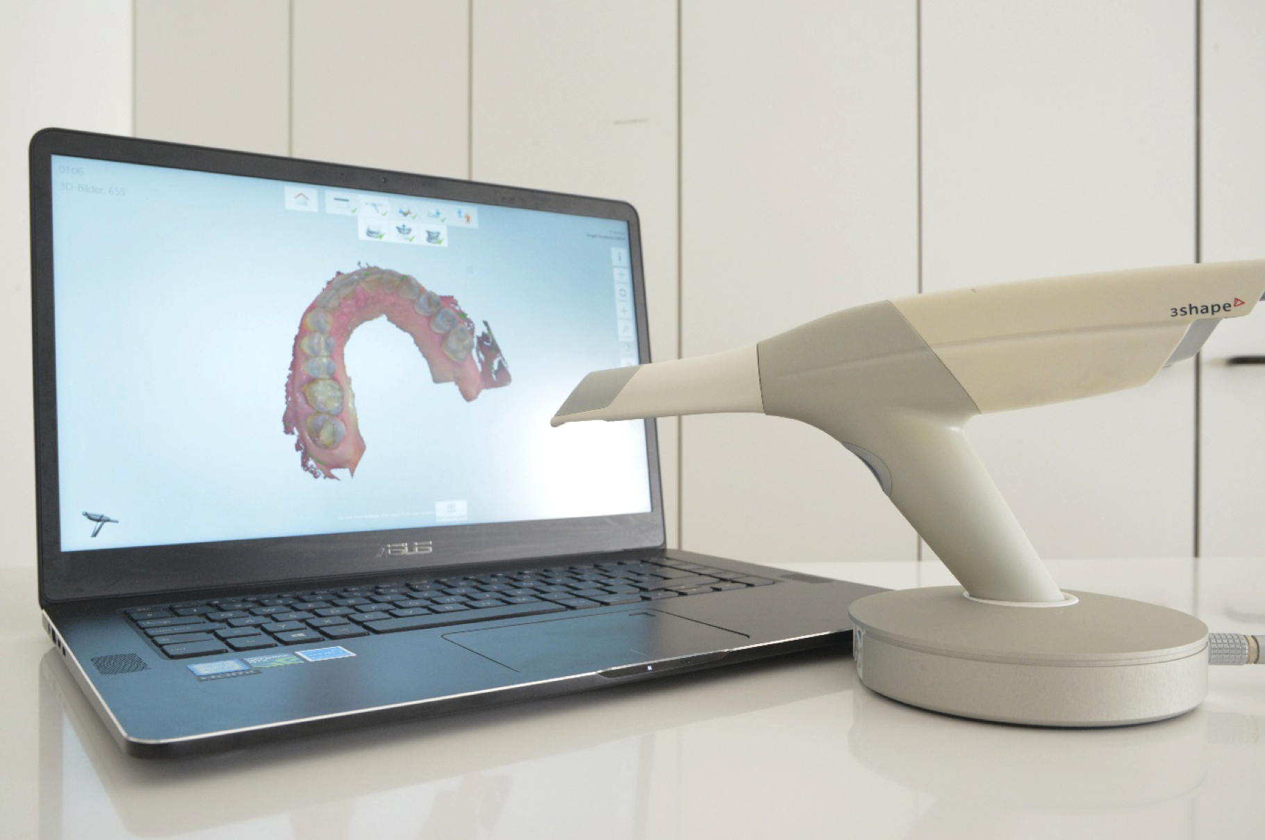 Durchsichtige Zahnspangen Mit dem 3D Scanner wird der Ist-Zustand des Gebisses erfasst (keine Abformung mit Löffel und Abform-Masse im Mund).