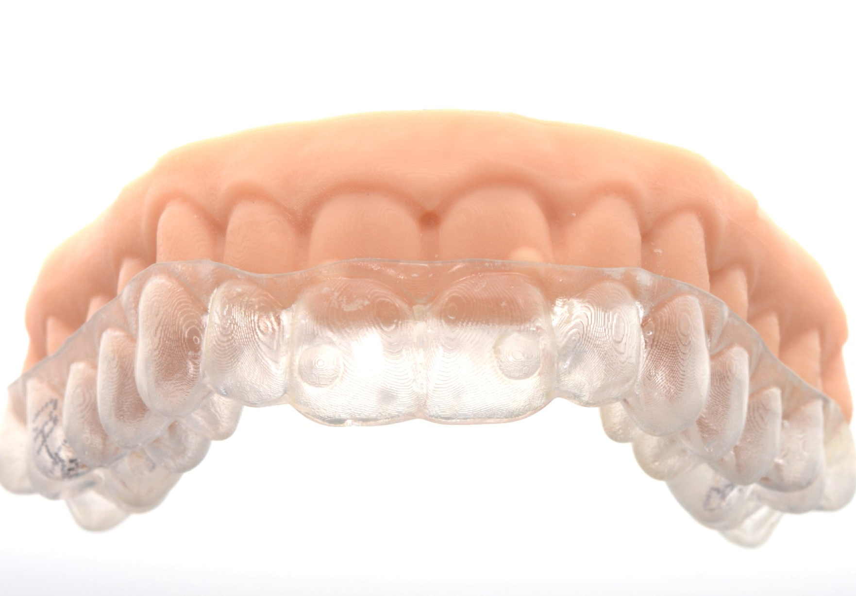 Durchsichtige Zahnspangen Aligner auf dem Modell. Das Modell wurde anhand der digitalen Planung mit einem 3D Drucker hergestellt.